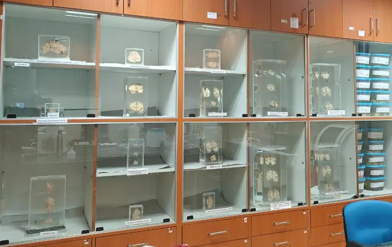 Brain specimens on display at the AIIMS Bhubaneswar Brain Museum